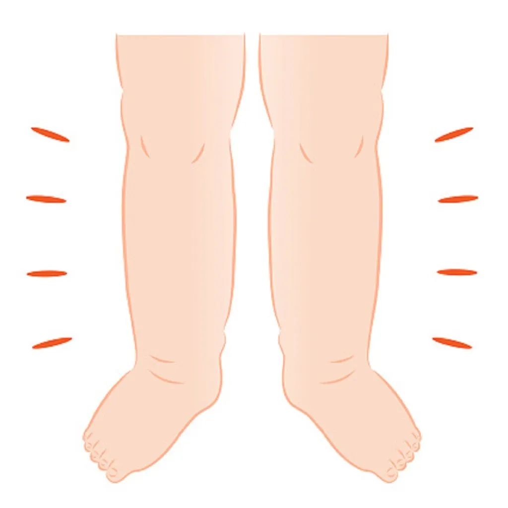Qué significa soñar con tener las piernas hinchadas | 1 INTERPRETACIÓN